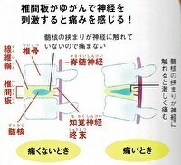 腰痛体操～マッケンジー体操について - 春日井で腰痛・肩こりの