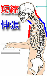 捻ると痛い腰痛の原因と治療について 春日井で腰痛なら鍼灸マッサージ室ゆうせん